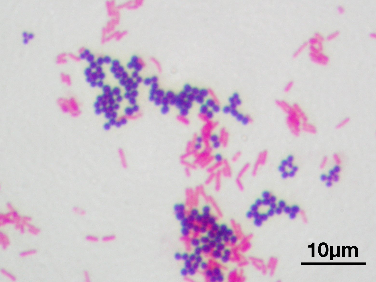 Photomicrograph of gram-positive and gram-negative bacteria with differential staining - OCR A Level Biology revision