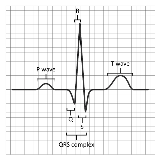 Labelled ECG trace with P and T wave and QRS complex - OCR A Level Biology revision